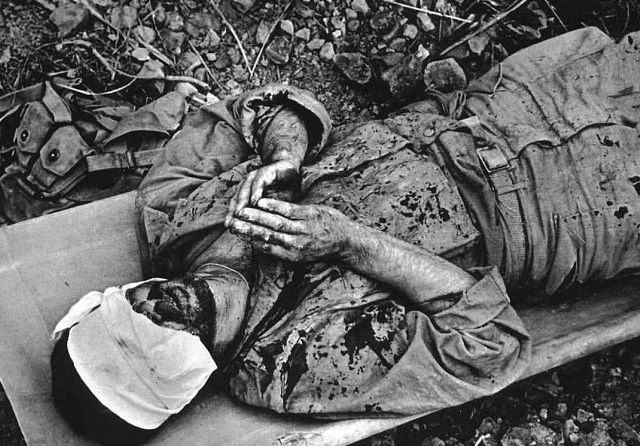 照片,被炸伤的老兵躺在担架上祈祷,第一张让人痛心|士兵|张让|战争