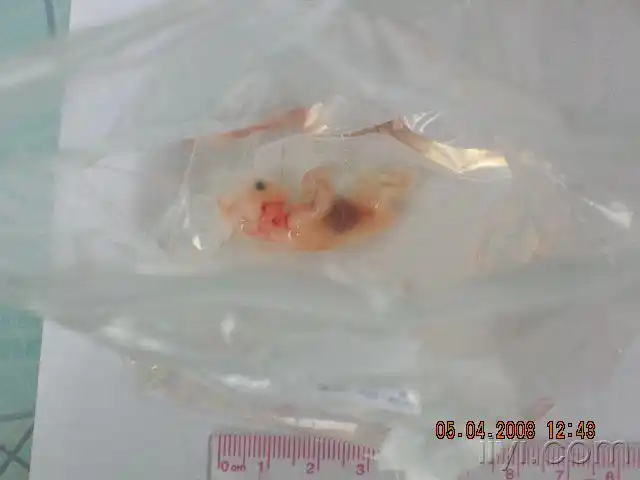 来看看3个月大的胎儿真实图片