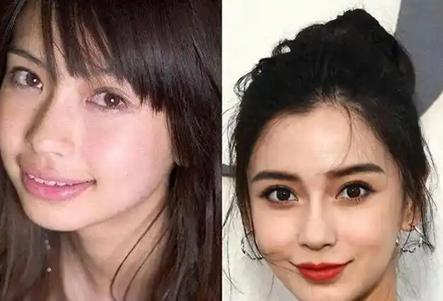 了众多明星,他们的容貌美得如同仙境般绝美,然而却在奇特的口腔上失意