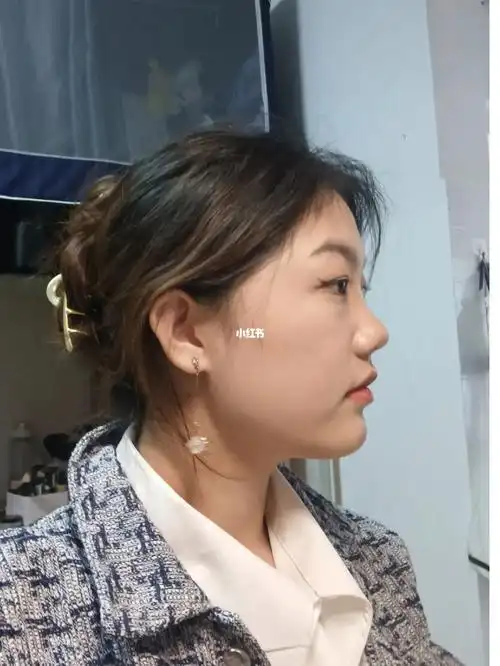 好讨厌方圆脸这么大的脸部留白