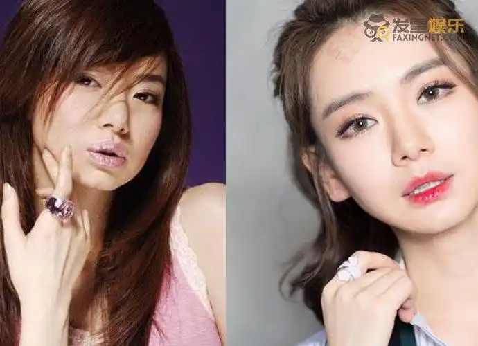 戚薇整容前后照片 直面整容质疑大方承认割双眼皮