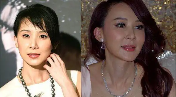 女明星整容前后对比,杨幂李小璐郑爽都成功了,她却面目全非