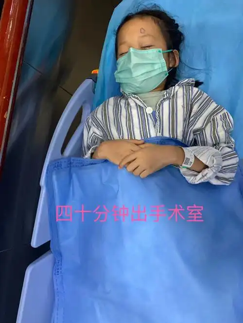 斜视手术后出现重影正常么