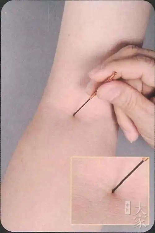 曲陵穴——肩周炎特效穴,呼吸运针,吸气进呼气出21次,神效!