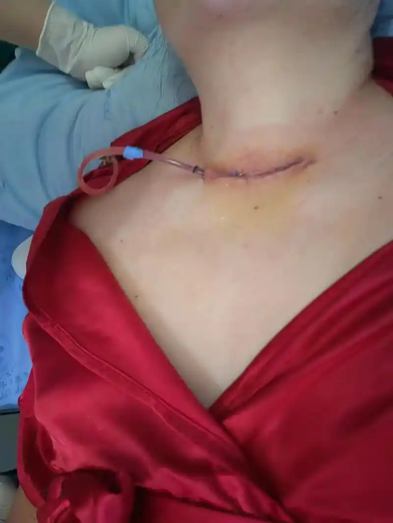 这个破铜烂铁的身体上,又留下一道疤痕,我的人生就是一场酸苦辣 - 抖