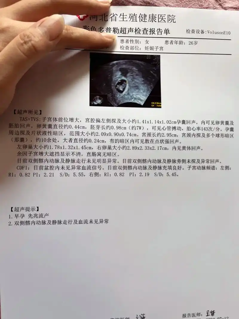 这段时间没更新,一直在努力保胎中,宝宝孕囊小,发育的也慢,但是一直有