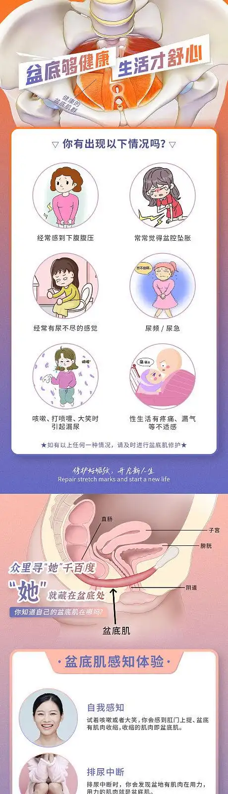 女性产后妊娠纹腹直肌盆底肌问题海报