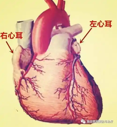 左心耳(left atrial appendage,laa)
