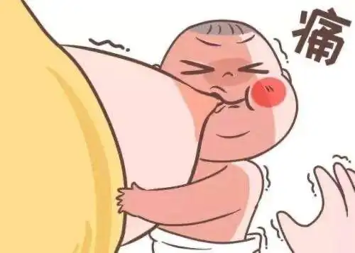 哺乳期乳头破损怎么办我用过的方法送给你4点预防工作要做好