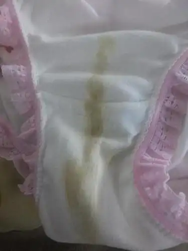 内裤上有黄色分泌物是怀孕了么