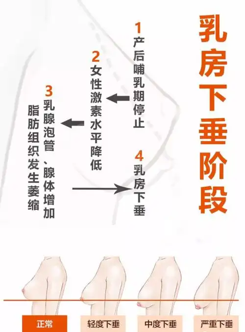 怀孕后乳头变大变黑产后能恢复吗