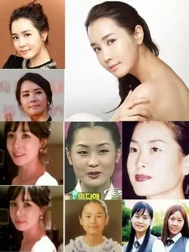 组图韩国体娱明星整容集锦变脸前后对比大反差
