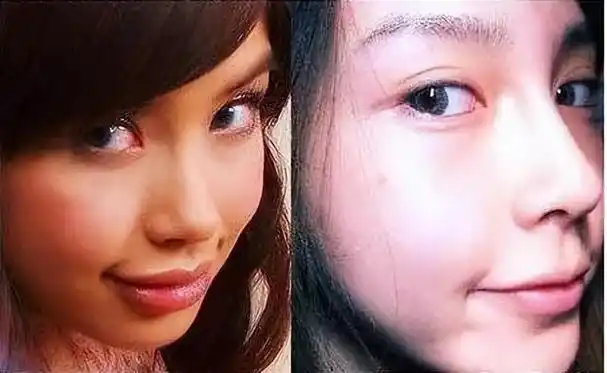 "凤姐"同款的香肠嘴,变成了令人沉醉的微笑唇.