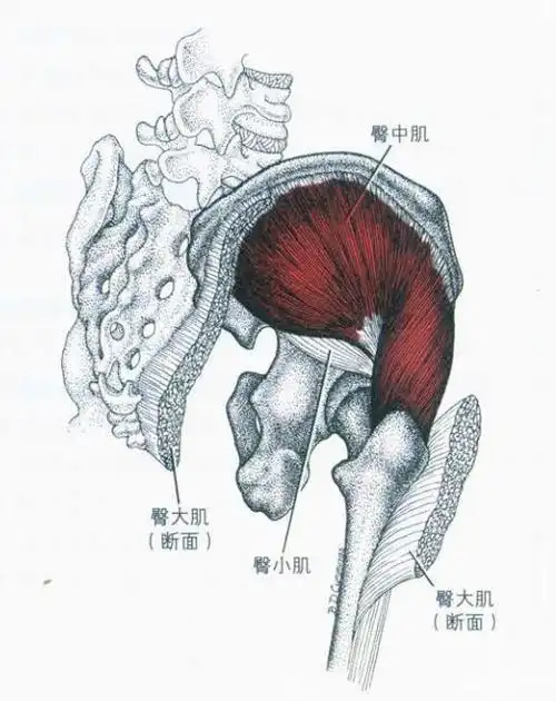 大腿外侧根部痛,竟然是大转子滑囊炎|肌肉|张力|臀大肌|炎症_网易订阅