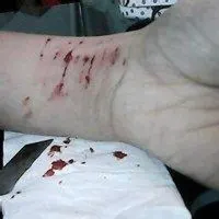 带血的伤感自残头像图片大全点击鼠标右键下载