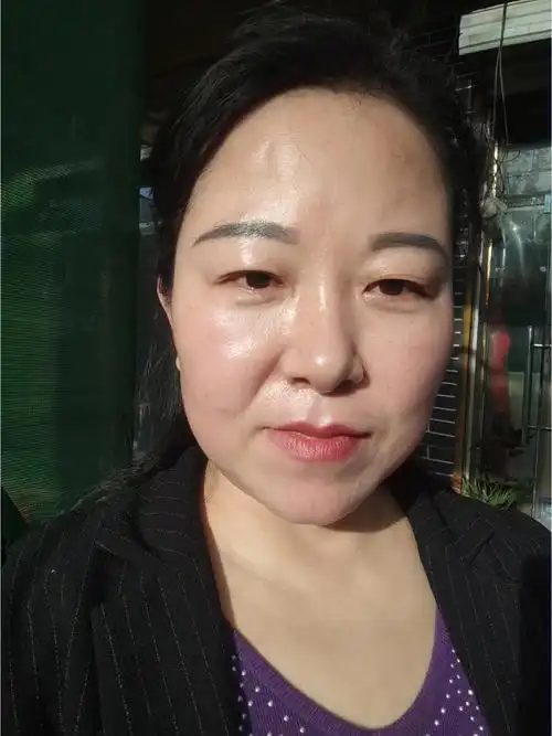 70后阿姨的皮肤状态