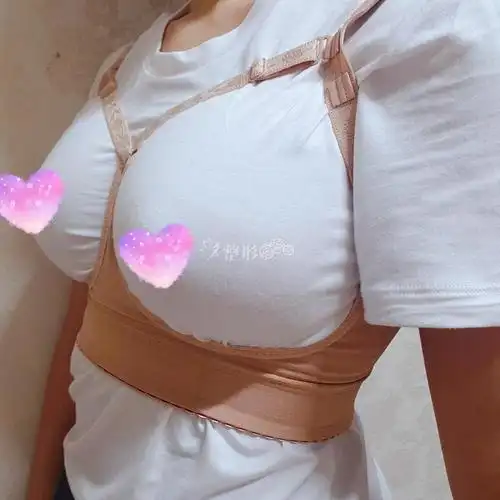 魔滴胸12天已显魅力_韩国整形社区_韩国整容问答_韩国整形经验交流