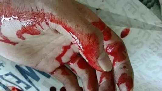 干净的自残照片清晰,干净的自残照片-图片大观-奇异网