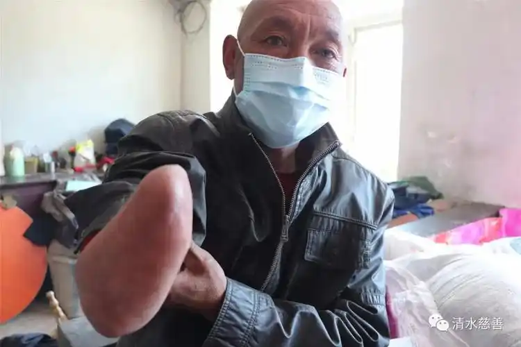犯病的时候付不起医疗费,一直在家休养,还有一只胳膊截肢了