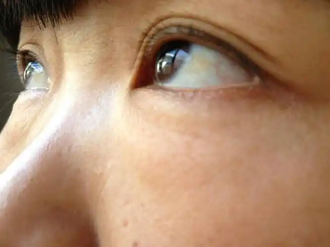 眼睛眼球白色部分有横向的黄色东西 这个是怎么回事?