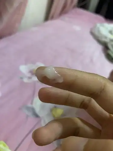 这种白带正常么