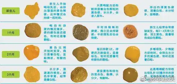 超臭便=食蛋白质多;亮便=食脂肪多;绿便=食铁多(或饥饿性腹泻);蛋花汤