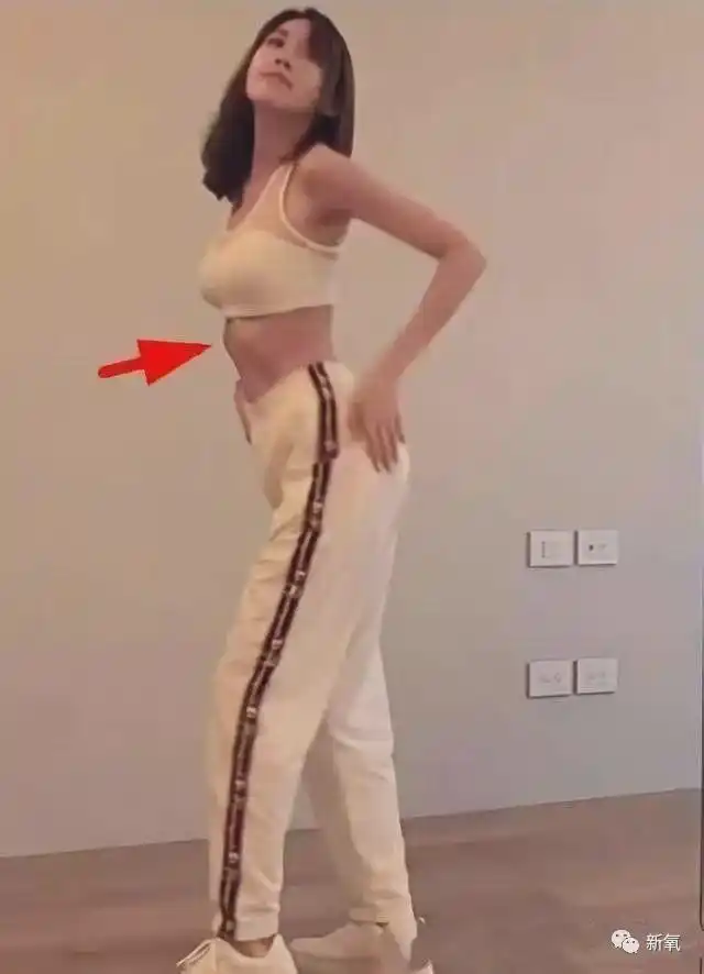 陈若仪的肋骨外翻就还蛮明显的