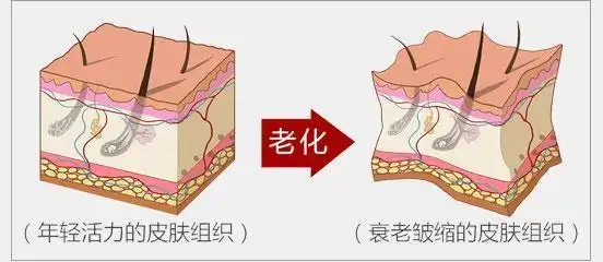 皮肤衰老的原理