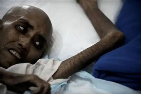 美泰两国研制出艾滋病"准疫苗"(组图)