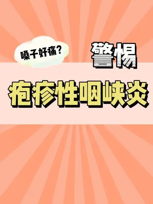 疱疹性咽峡炎是一种特殊的急性上呼吸道感染通过接触,粪口以及飞沫