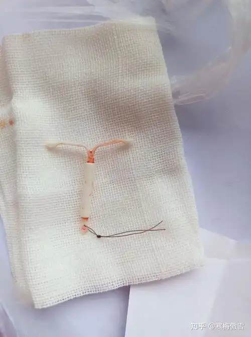 因子宫憩室上曼月乐过程