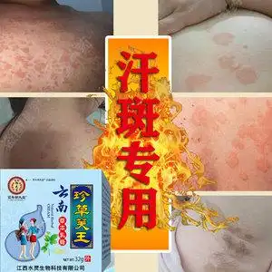 9028人付款淘宝白癜风外用黑色素生长治疗外用内服中药偏方长汗斑