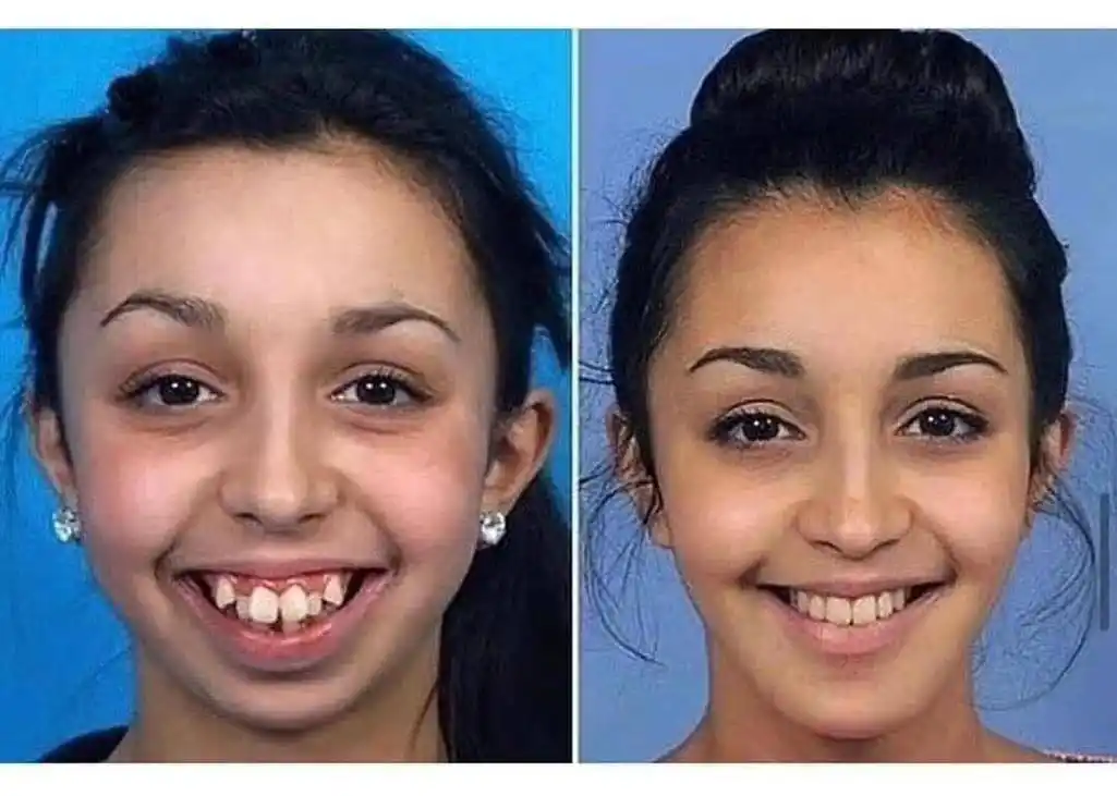 首位破百亿票房的00后演员,曾经却因牙齿不齐,自卑到不敢笑