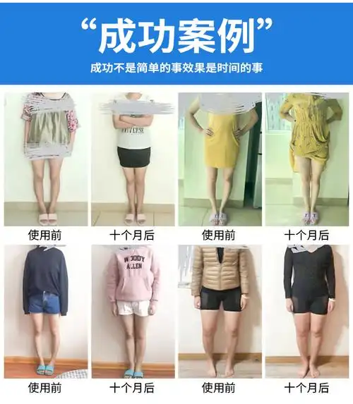 o型腿矫正鞋垫罗圈腿矫正器