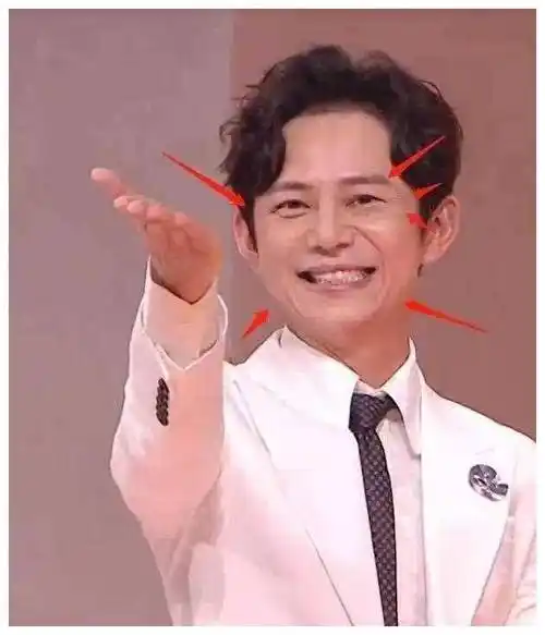 49岁何炅近照满脸皱纹,皮肤松弛面容憔悴,"不老男神"是假的