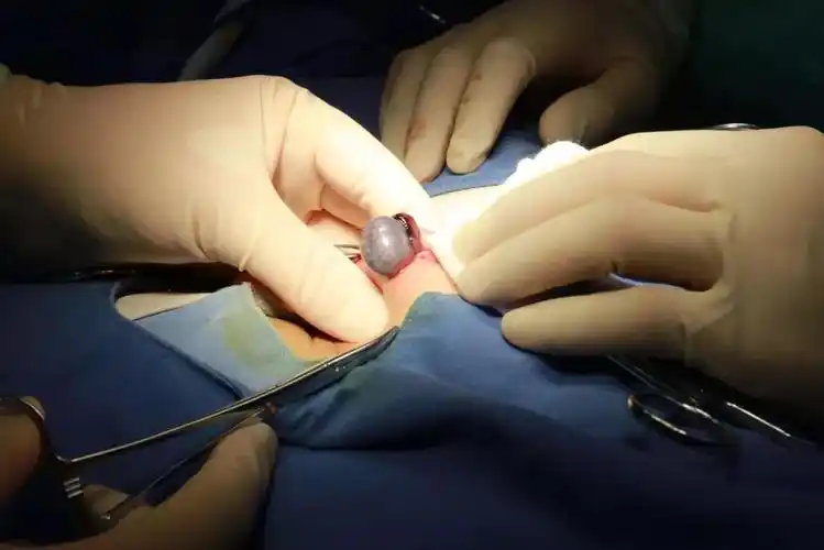 接诊医生王晋辉副主任通过查体发现男孩阴囊肿胀,立刻安排彩超等系列