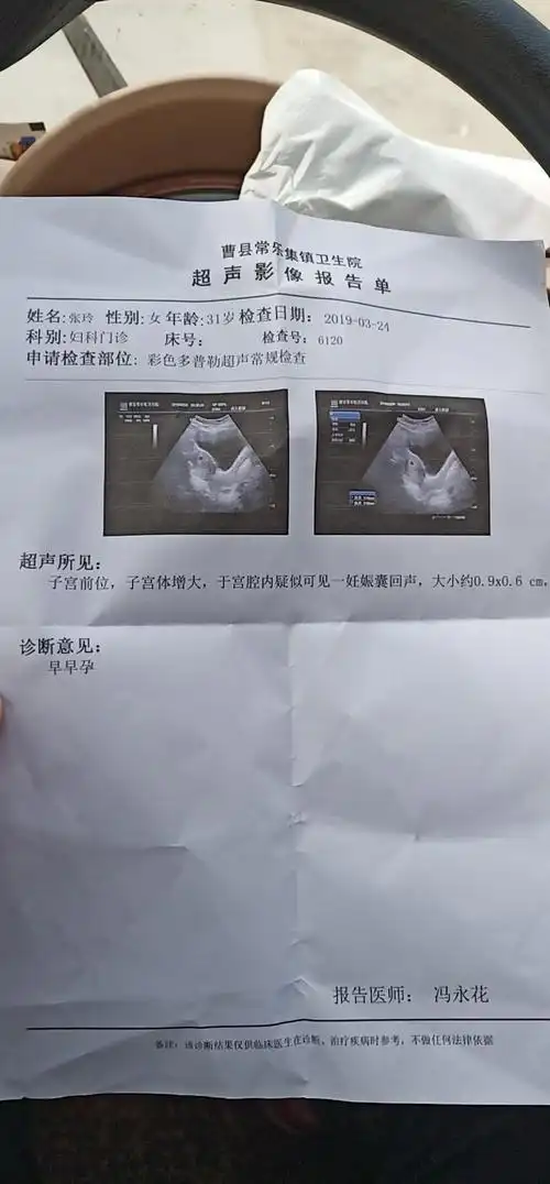 零风险!孕囊大小看男女99%准确对照表"壮志凌云"-第1张图片-凯飞博客