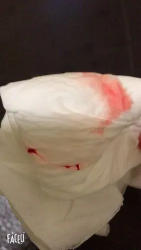 9月25号同房,十月5号来月经,十一月12好来点黑色