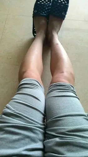 属于轻度o型腿,16岁.使用矫正带需要多久.