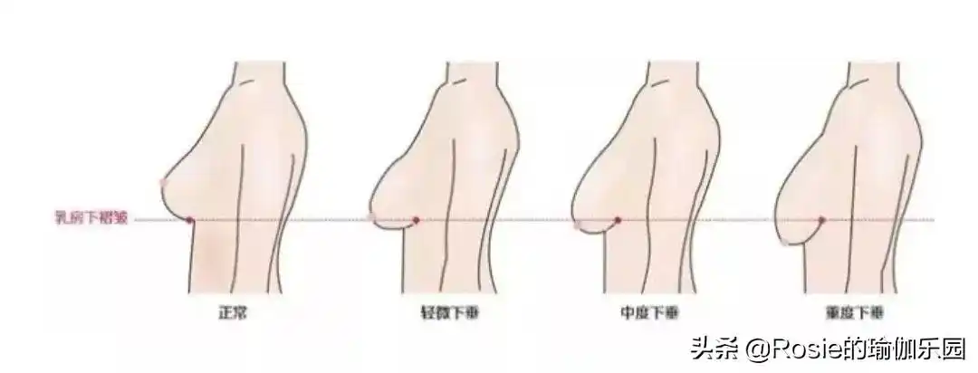 张雨绮狂甩50斤前凸后翘,如何拥有同款美胸?做好这两点