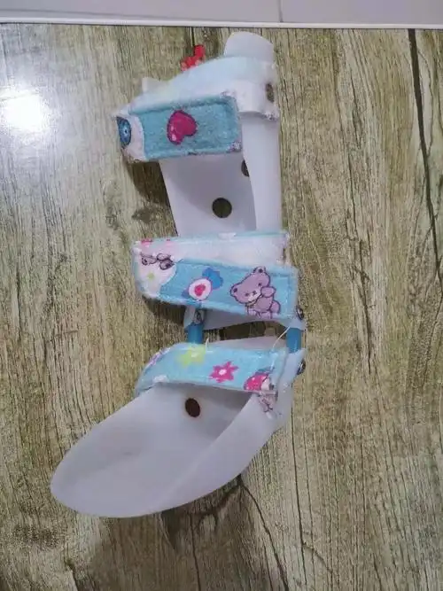 医生谈矫正:尖足矫正鞋需个性化定制