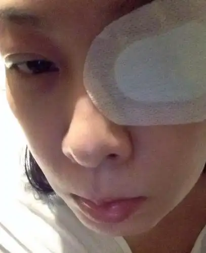 刘若英眼睛现血块 贴纱布惨变独眼龙(组图)