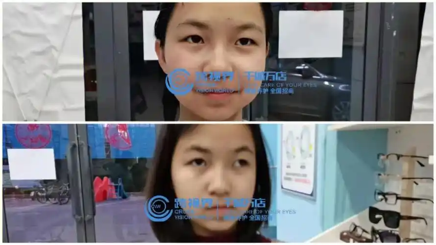 斜视不动手术就好了