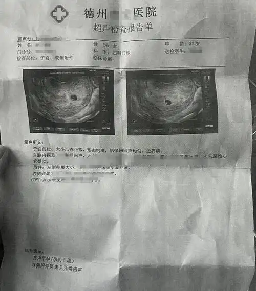 2022年的10月,崔某伪造了自己怀孕的超声报告,称回老家养胎,并以此为