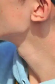 中学生喉结图片