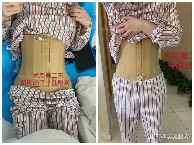 也是科班出身,从事医美行业20多年,三甲副高级,擅长做各部位脂肪的