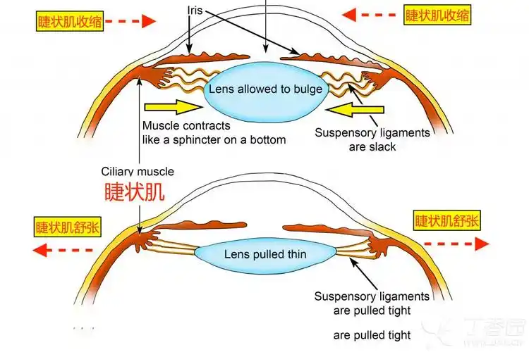 人之所以近视的原因,也是因为睫状肌长期收缩导致的痉挛