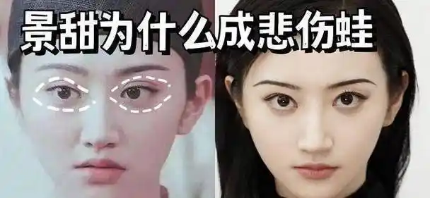 景甜为什么成悲伤蛙?_眼睛_双眼皮_显得