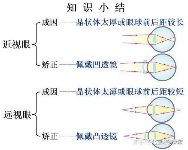 近视远视可以同时存在在一只眼睛上吗?