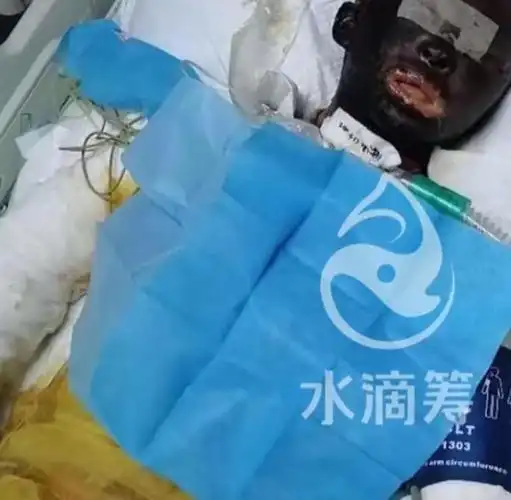 网友:一个眼里有光的女性|素颜|一笑|烧伤_网易订阅